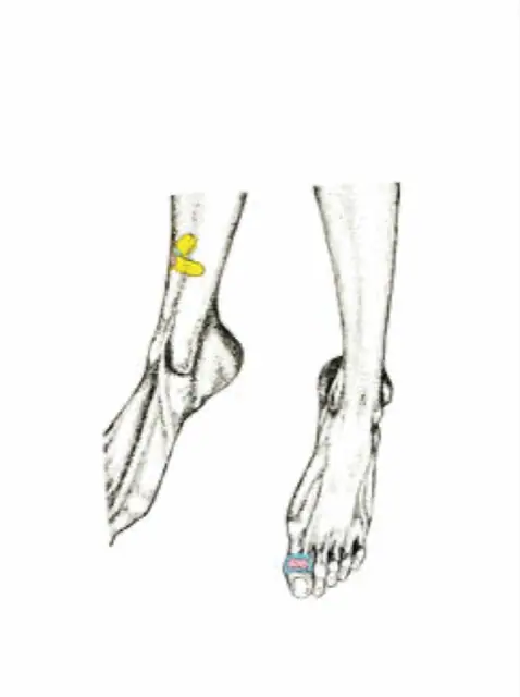 Legs